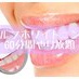 coupon photo
