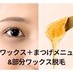 coupon photo