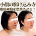 coupon photo